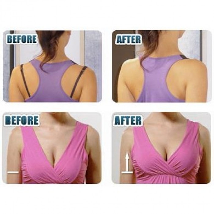 3 Pcs Set Strap Perfect Bra Concealer Clip 1335-SP